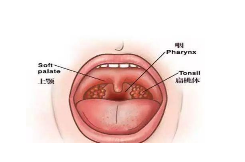 小孩張嘴睡覺一定是腺樣體肥大嗎，腺樣體對寶寶的危害有多大？